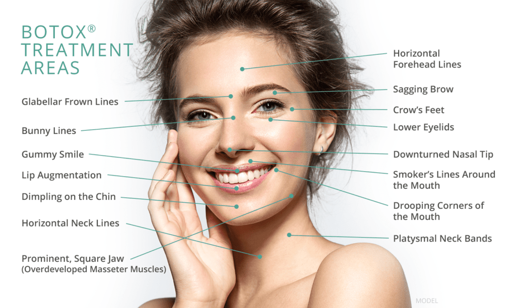 Botox benefits & uses