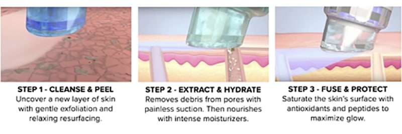 HydraFacial treatment steps