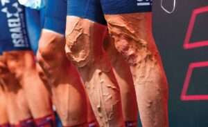 Home - Signature Aesthetica Varicose veins treatment in Istanbul