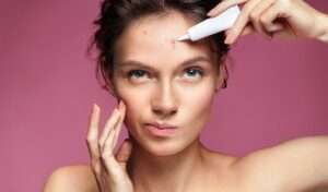 Acne treatment in Istanbul
