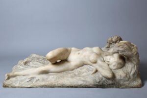 Labiaplasty in Istanbul - Turkey